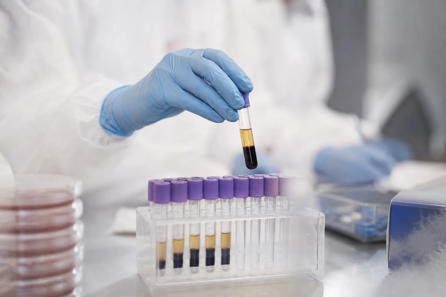 Comprendre les raisons pour lesquelles les marqueurs tumoraux augmentent : implications pour le diagnostic et le suivi